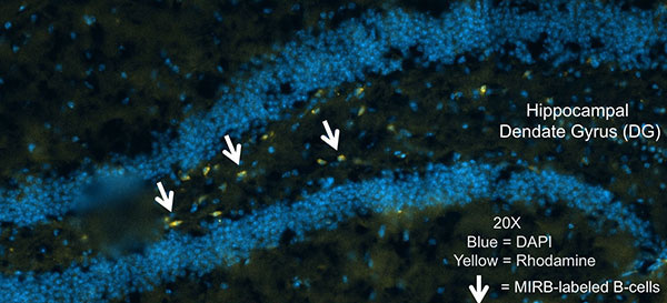 Diagram showing the role of T-cells in stroke recovery